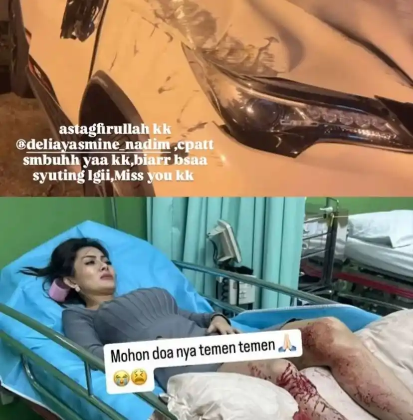 Pesinetron Delia Yasmine Kecelakaan di Tol Jagorawi [Foto: Instagram/@bebbyvieee_new]
