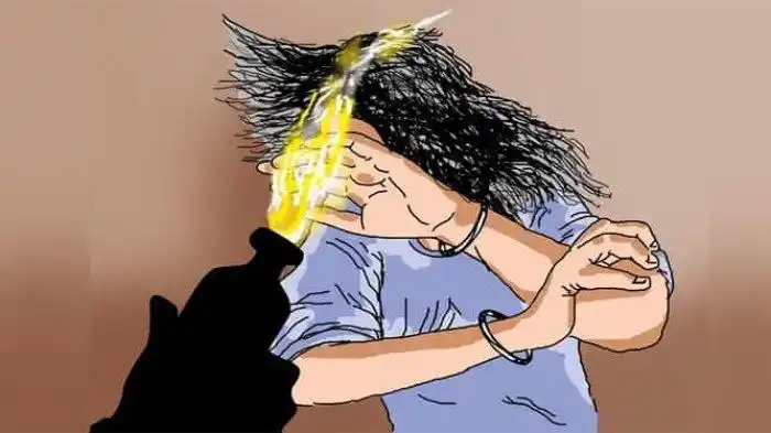 Ilustrasi. Seorang wanita disiram air keras di Bekasi (Foto: Ist)