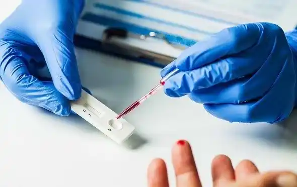 Ilustrasi - Rapit Test Antibodi (Foto: Istimewa)